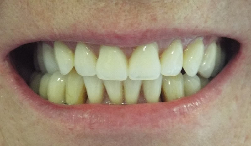 Image after the treatment