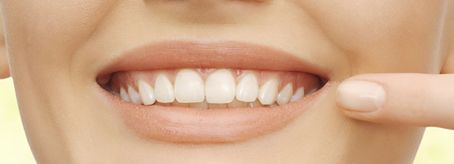 six month smiles ireland cork